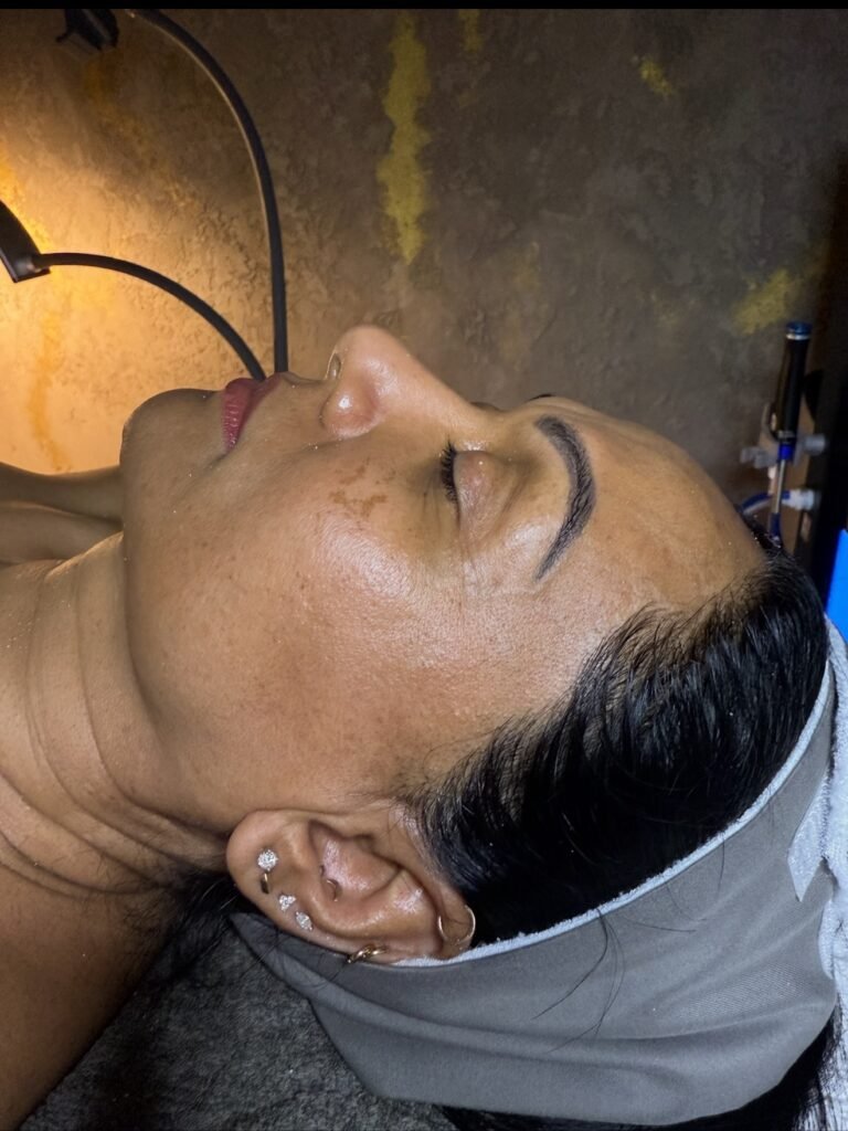 BioRePeel treatment session at Skin Care Supreme, Westbury NY